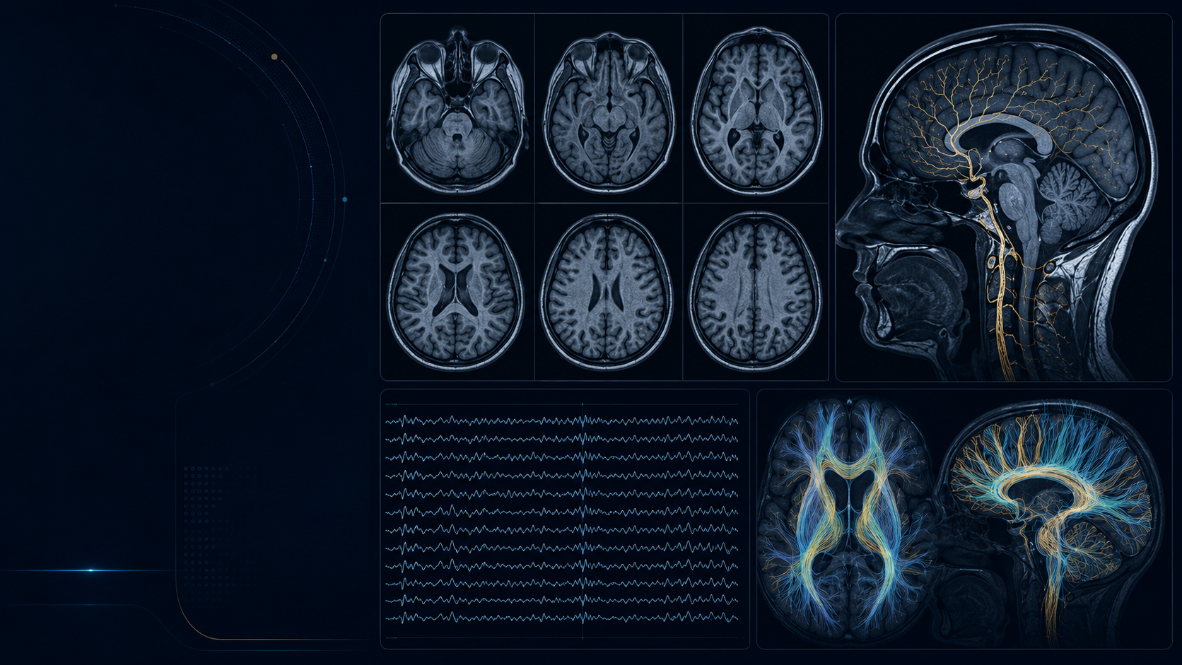Clinical Neurology MRI, EEG and tractography visualization